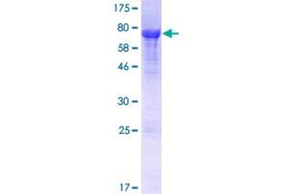 WNK1 Protein (AA 1-434) (GST tag)