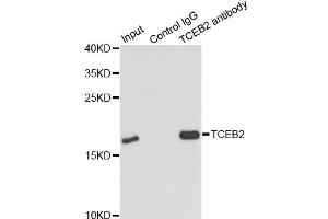Immunoprecipitation analysis of 150ug extracts of MCF7 cells using 3ug TCEB2 antibody (ABIN6292903).