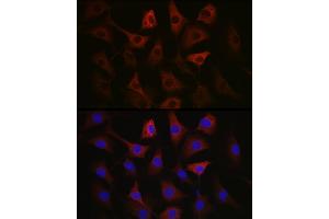 Immunofluorescence analysis of NIH/3T3 cells using GAPDH Mouse mAb (ABIN3020540, ABIN3020541, ABIN3020542 and ABIN1512934) at dilution of 1:100 (40x lens). (GAPDH antibody)