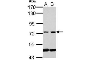 WB Image Sample (30 ug of whole cell lysate) A: Jurkat B: Raji 7. (GLMN antibody)