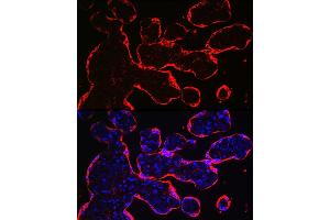 Immunofluorescence (IF) image for anti-Hydroxy-delta-5-Steroid Dehydrogenase, 3 beta- and Steroid delta-Isomerase 1 (HSD3B1) (AA 1-290) antibody (ABIN6142016)
