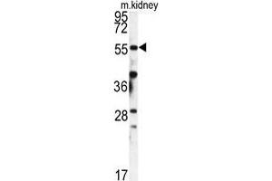 Western blot analysis of FKBP9 antibody (N-term) in mouse kidney tissue lysates (35 µg/lane).