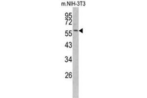 Western blot analysis of KRT14 antibody (Center) in NIH-3T3 cell line lysates (35ug/lane).