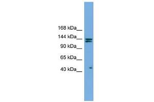 WB Suggested Anti-IARS Antibody Titration: 0. (IARS antibody  (Middle Region))