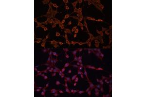 Immunofluorescence analysis of NIH-3T3 cells using  Polyclonal Antibody (ABIN6129850, ABIN6136348, ABIN6136349 and ABIN6224537) at dilution of 1:100 (40x lens). (ABCB11 antibody  (AA 600-750))