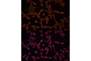 Immunofluorescence analysis of NIH-3T3 cells using  Polyclonal Antibody (ABIN6129850, ABIN6136348, ABIN6136349 and ABIN6224537) at dilution of 1:100 (40x lens). (ABCB11 antibody  (AA 600-750))