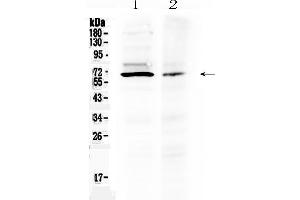 Western blot analysis of AMH using anti- AMH antibody . (AMH antibody  (AA 75-141))
