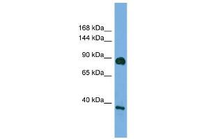 Western Blotting (WB) image for anti-Discs, Large Homolog 4 (Drosophila) (DLG4) (Middle Region) antibody (ABIN2784457)
