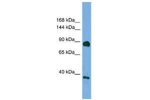 WB Suggested Anti-DLG4 Antibody Titration: 0. (DLG4 antibody  (Middle Region))