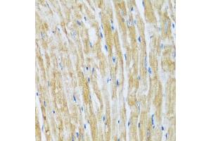 Immunohistochemistry of paraffin-embedded mouse heart using B antibody (ABIN7265851) at dilution of 1:100 (40x lens). (BAG3 antibody  (AA 380-575))