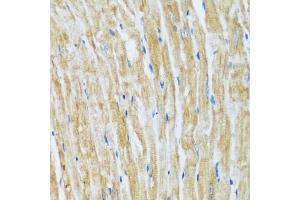 Immunohistochemistry of paraffin-embedded mouse heart using B antibody (ABIN7265851) at dilution of 1:100 (40x lens).