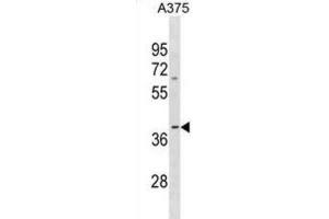 Western Blotting (WB) image for anti-Olfactory Receptor, Family 13, Subfamily D, Member 1 (OR13D1) antibody (ABIN3001031) (OR13D1 antibody)