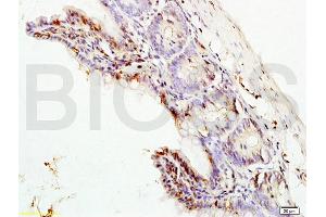 Formalin-fixed and paraffin embedded rat colon labeled with Rabbit Anti ERK1/MAPK3 Polyclonal Antibody, Unconjugated (ABIN736476) at 1:200 followed by conjugation to the secondary antibody and DAB staining (ERK1 antibody  (AA 101-200))