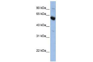 SLC45A3 antibody used at 1 ug/ml to detect target protein. (SLC45A3 antibody  (Middle Region))
