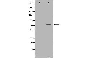 Western blot analysis of Hela whole cell lysates, using OLFM1 Antibody. (Olfactomedin 1 antibody)