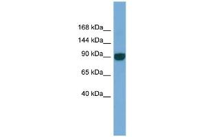 WB Suggested Anti-UNC45A Antibody Titration: 0. (UNC45A antibody  (N-Term))