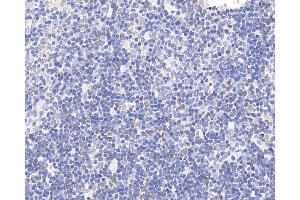 Immunohistochemistry analysis of paraffin-embedded rat thymus using CCR5 Polyclonal Antibody at dilution of 1:300.