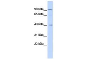 Image no. 1 for anti-Zinc Finger Protein 263 (ZNF263) (C-Term) antibody (ABIN6742791) (ZNF263 antibody  (C-Term))