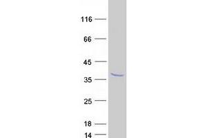 Validation with Western Blot