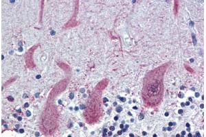 Human Brain, Cerebellum (formalin-fixed, paraffin-embedded) stained with ST18 antibody ABIN462193 followed by biotinylated goat anti-rabbit IgG secondary antibody ABIN481713, alkaline phosphatase-streptavidin and chromogen. (ST18 antibody  (AA 899-948))