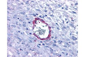 Anti-HRH1 / Histamine H1 Receptor antibody IHC of human Vessel. (HRH1 antibody  (Extracellular Domain))