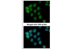 ICC/IF Image Immunofluorescence analysis of paraformaldehyde-fixed A431, using ARAF, antibody at 1:200 dilution. (ARAF antibody  (C-Term))