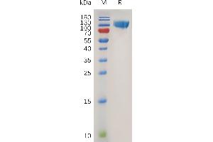 SDS-PAGE (SDS) image for CD276 (CD276) (AA 27-461) protein (mFc Tag) (ABIN7490943)