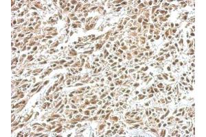 IHC-P Image IKB alpha antibody detects NFKBIA protein at nucleus on U251 xenograft by immunohistochemical analysis. (NFKBIA antibody  (Center))