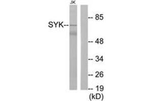 Western Blotting (WB) image for anti-Spleen tyrosine Kinase (SYK) (AA 314-363) antibody (ABIN2888610) (SYK antibody  (AA 314-363))