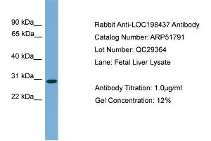 WB Suggested Anti-C20orf201  Antibody Titration: 0. (C20orf201 antibody  (C-Term))
