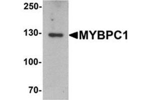 Western blot analysis of MYBPC1 in rat skeletal muscle tissue lysate with MYBPC1 antibody at 1 ug/mL. (MYBPC1 antibody  (N-Term))