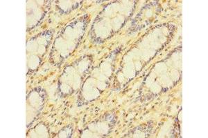 Immunohistochemistry of paraffin-embedded human colon tissue using ABIN7159692 at dilution of 1:100 (APOOL antibody  (AA 163-268))