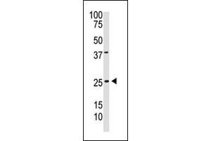 The anti-PDGFB C-term Pab (ABIN388460 and ABIN2848858) is used in Western blot to detect PDGFB in  cell lysate. (PDGFB antibody  (C-Term))