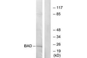 Western blot analysis of extracts from 293 cells, treated with Forskolin, using BAD (Ab-155) Antibody. (BAD antibody  (AA 119-168))