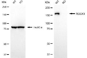Western blotting analysis using ROCK1 antibody (ABIN7800204). (Recombinant ROCK1 antibody)