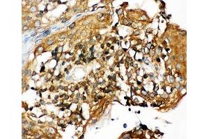 IHC-P: NLRP3 antibody testing of human tonsil tissue (NLRP3 antibody  (N-Term))