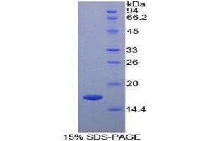 SDS-PAGE (SDS) image for Retinol Binding Protein 5, Cellular (RBP5) (AA 1-135) protein (His tag) (ABIN1080665)