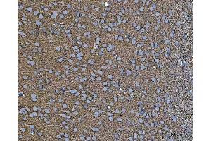 IHC analysis of EAAT2/GLT-1/SLC1A2 using anti-EAAT2/GLT-1/SLC1A2 antibody (ABIN3043436).