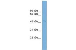 Image no. 1 for anti-Matrix Metallopeptidase 3 (Stromelysin 1, Progelatinase) (MMP3) (AA 162-211) antibody (ABIN6745485) (MMP3 antibody  (AA 162-211))