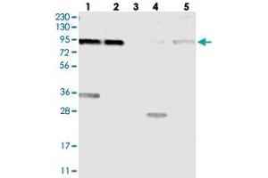 Western blot analysis of Lane 1: RT-4, Lane 2: U-251 MG, Lane 3: Human Plasma, Lane 4: Liver, Lane 5: Tonsil with KIAA1024 polyclonal antibody  at 1:250-1:500 dilution. (KIAA1024 antibody)