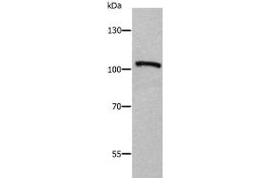 Western Blot analysis of Human fetal brain tissue using ADAMTS5 Polyclonal Antibody at dilution of 1:650