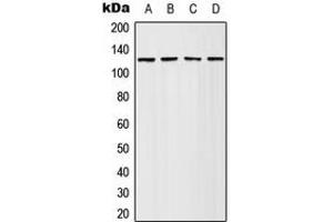 Western blot analysis of Adenylate Cyclase 4 expression in HeLa (A), Jurkat (B), SP2/0 (C), PC12 (D) whole cell lysates. (ADCY4 antibody  (Center))