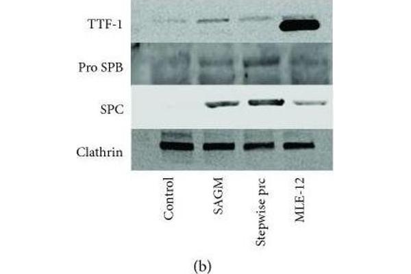 Surfactant Protein C antibody  (AA 1-193)