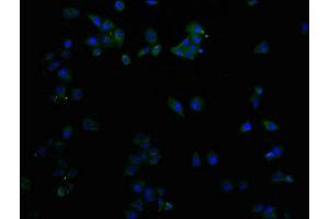 Immunofluorescence staining of Hela cells with ABIN7147203 at 1:50, counter-stained with DAPI.