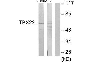 Western blot analysis of extracts from HUVEC cells and Jurkat cells, using TBX22 antibody. (T-Box 22 antibody  (N-Term))