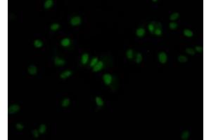 Immunofluorescence staining of MCF7 Cells with ABIN7127589 at 1:50, counter-stained with DAPI. (Recombinant JunB antibody)