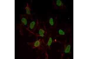 Immunofluorescence analysis of Hela cells using ESR1 mouse mAb (green). (Estrogen Receptor alpha antibody)