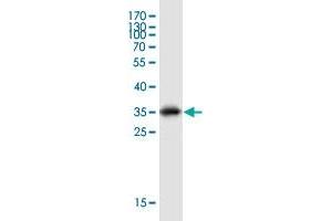 Western Blot detection against Immunogen (35. (NDUFA4 antibody  (AA 1-81))