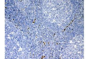 IHC analysis of IL33 using anti-IL33 antibody . (IL-33 antibody  (AA 95-270))