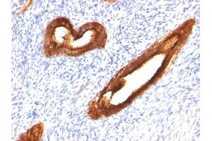 Immunohistochemistry (IHC) image for anti-Mucin 1 (MUC1) antibody (ABIN6940099)